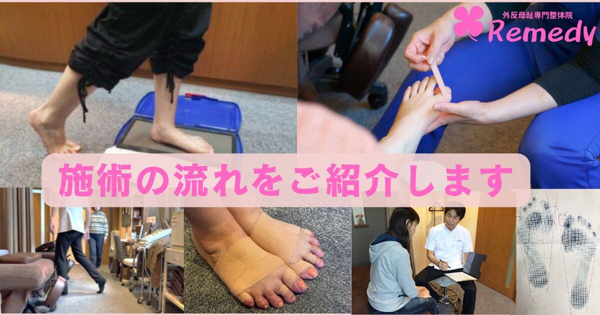 施術の流れをご紹介します 初めての方も安心して受けられる、やさしい外反母趾ケア